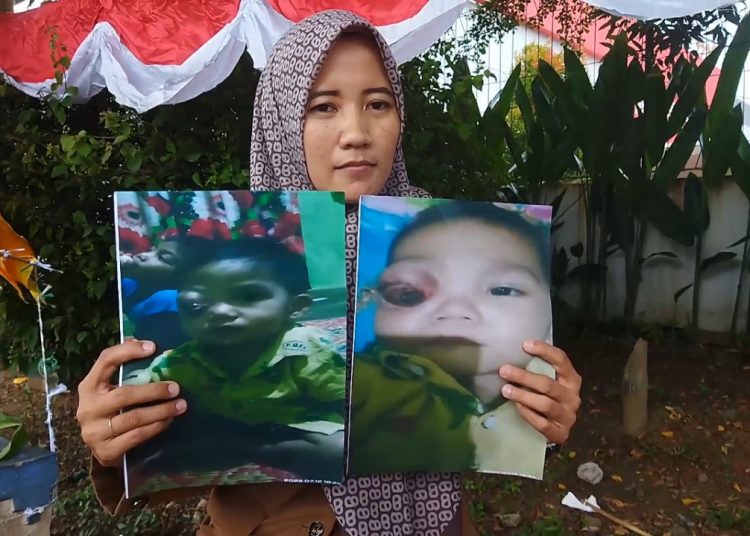 Demi Bayar Pengobatan Tumor Balita, Kepala Sekolah di Lampung Jual Bendera